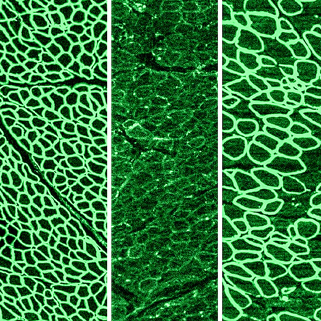 Image: In a recent study, CRISPR gene editing was shown to halt the progression of Duchenne muscular dystrophy (DMD) in dogs. The photomicrographs show dystrophin (in green) in a healthy diaphragm muscle (left), absence of dystrophin in a dog with DMD (center), and restoration of dystrophin in dogs treated with CRISPR (right) (Photo courtesy of the University of Texas Southwestern Medical Center).