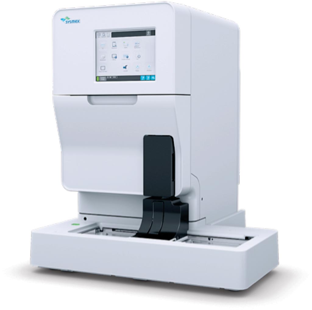 Image: The UF-5000 Urine fluorescence flow cytometry analyzer (Photo courtesy of Sysmex).