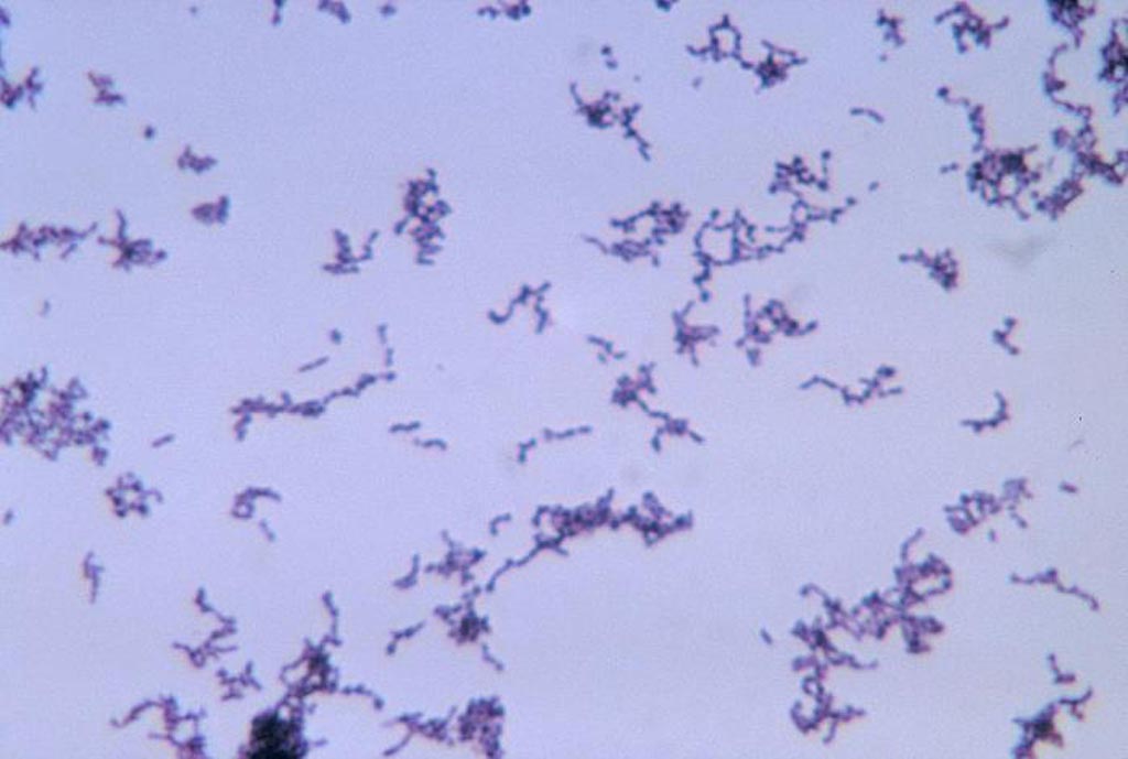 Image: A photomicrograph of the Gram-positive bacterium, Propionibacterium acnes growing in thioglycollate medium. P. acnes bacteria, which normally reside in the sebaceous glands of the skin, are responsible for acne vulgaris, or pimples (Photo courtesy of the [U.S.] Centers for Disease Control and Prevention).