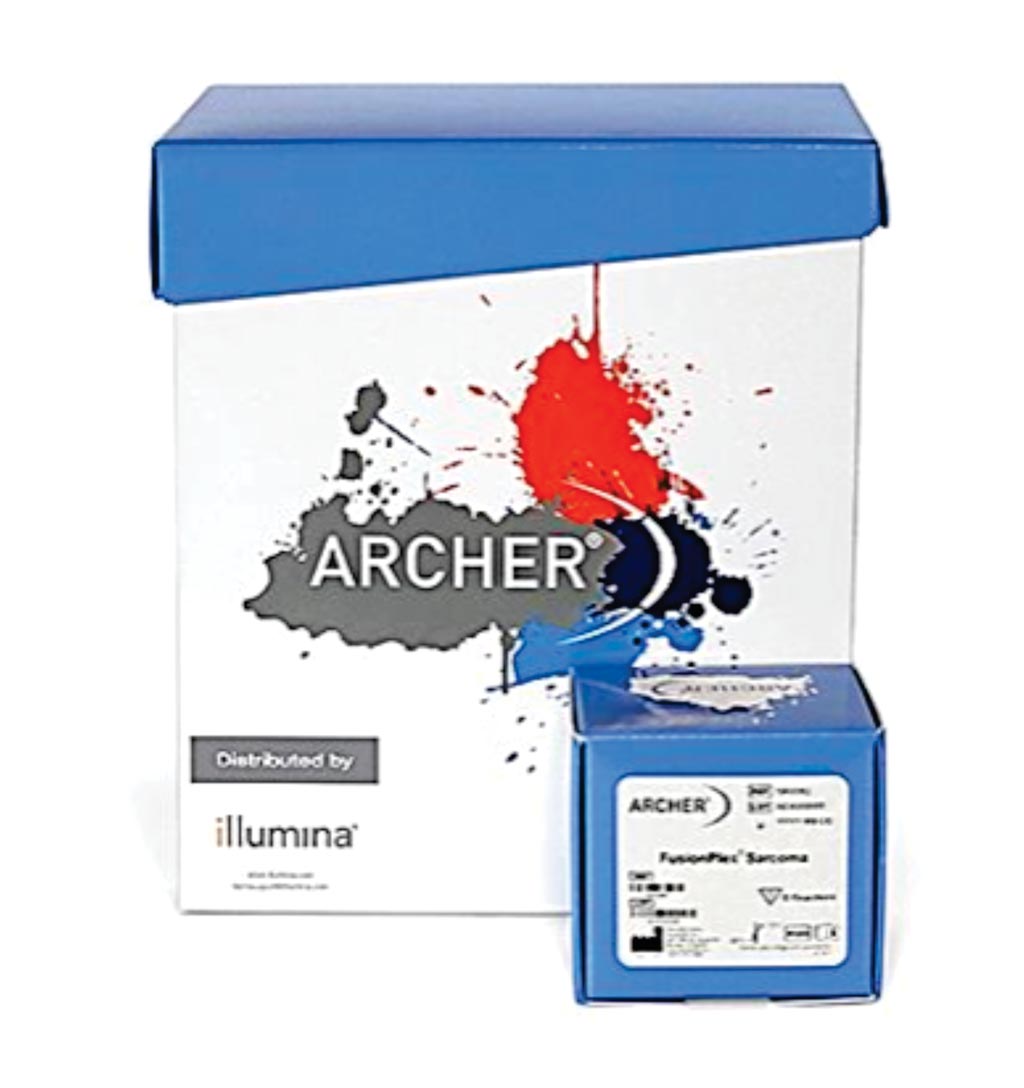 Image: The Archer FusionPlex Sarcoma Kit: A targeted sequencing assay to simultaneously detect and identify fusions of 26 genes associated with soft tissue cancers (Photo courtesy of Illumina).