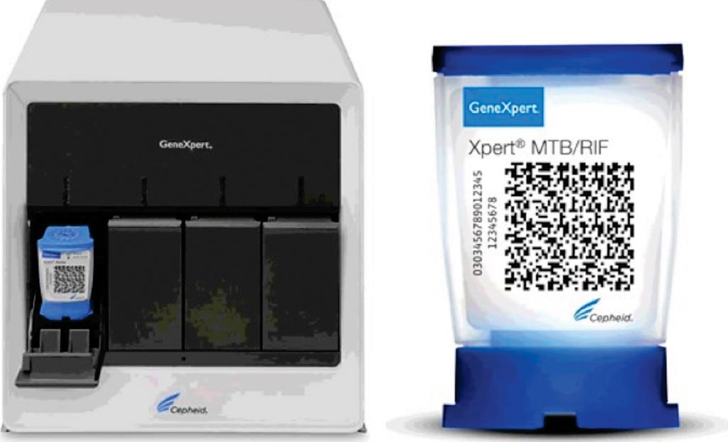 Image: The GeneXpert system and MTB/RIF test cartridge for the molecular detection of Mycobacterium tuberculosis complex and rifampin resistance-associated mutations (Photo courtesy of Cepheid).