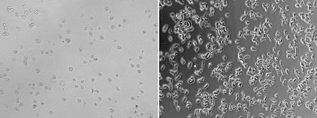 Image: N. fowleri growth is inhibited with a combination treatment of breast cancer drug tamoxifen and epiminolanosterol (left) as compared to the untreated amoebae (right) (Photo courtesy of the University of California San Diego).