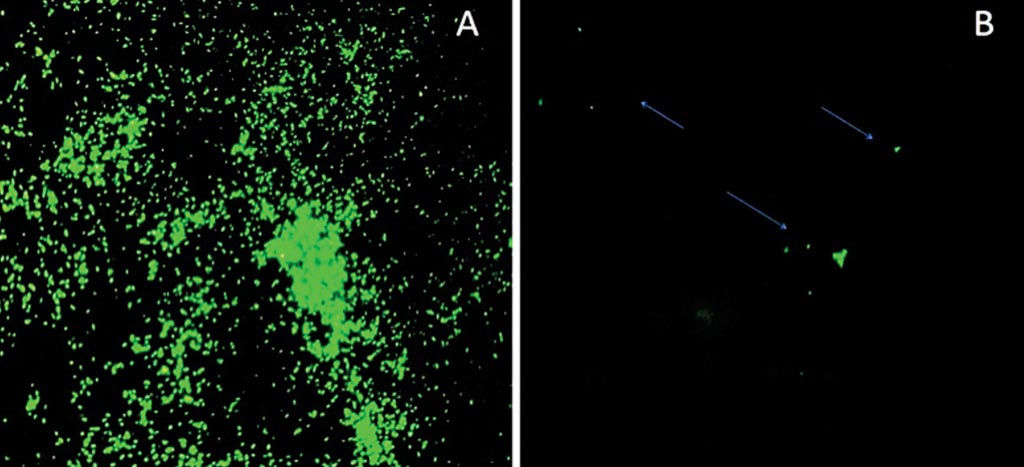 Image: Auramine O stained Mycobacterium leprae in FFPE tissue section under ×40 objective of light-emitting diode fluorescence microscope A: Sample with high BI; B. Sample with low BI (Photo courtesy of Armauer Hansen Research Institute).