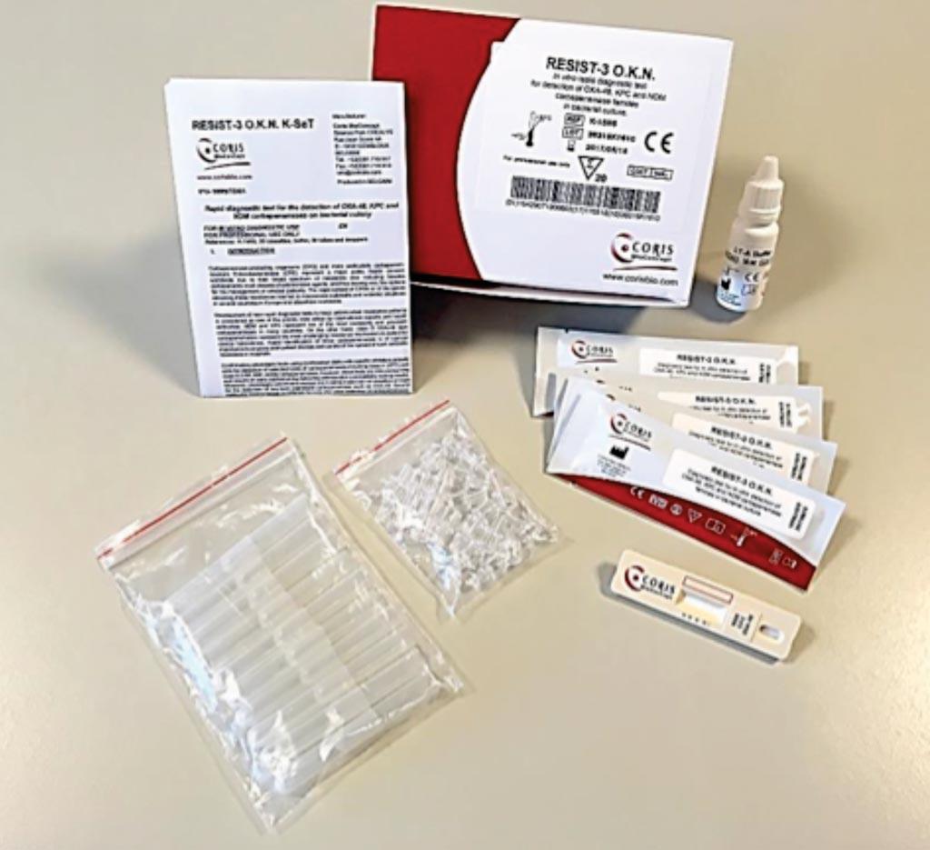 Image: A single immunochromatography test for the triple independent identification of OXA-48-like, KPC and NDM carbapenemase on bacterial colony using the RESIST-3 O.K.N. assay (Photo courtesy of Coris BioConcept).