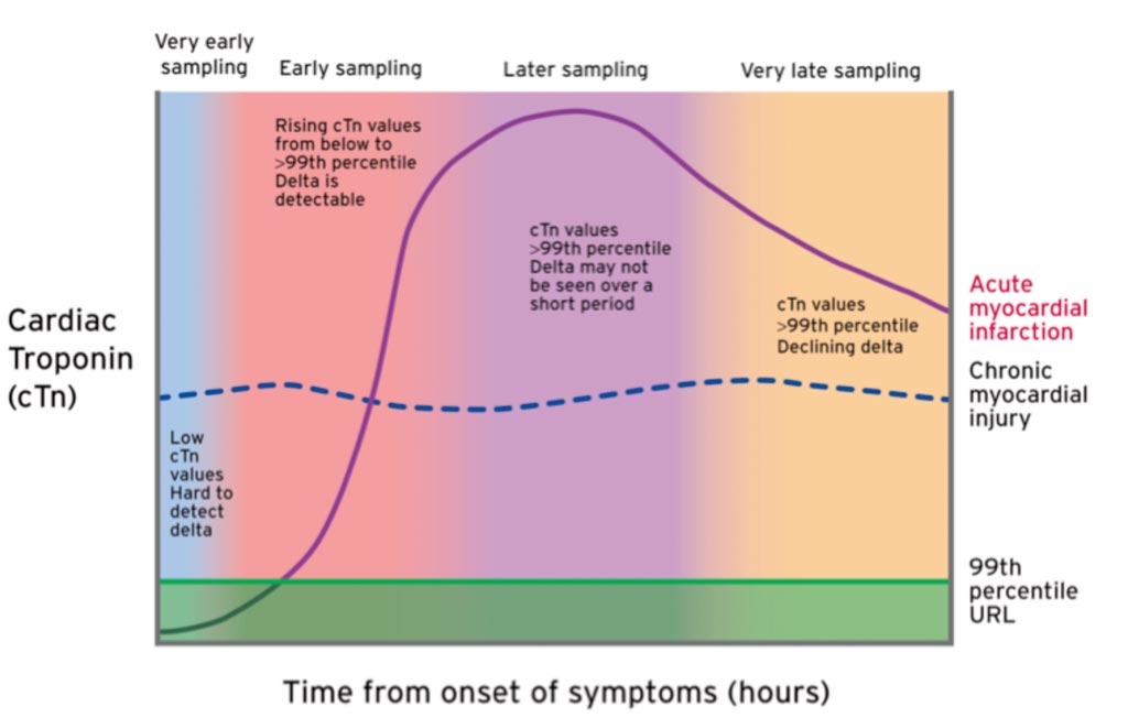 Image: An illustration of early cardiac troponin kinetics in patients after acute myocardial injury including acute myocardial infarction (Photo courtesy of ESC Scientific Document Group).