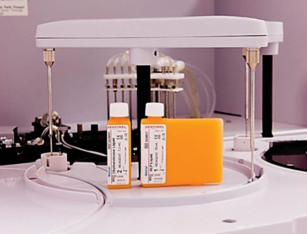 Image: An albumin immunoturbidimetric assay urine or serum plasma; standard microalbumin range is 0.4-500mg/L (Photo courtesy of Sentinel Diagnostics).