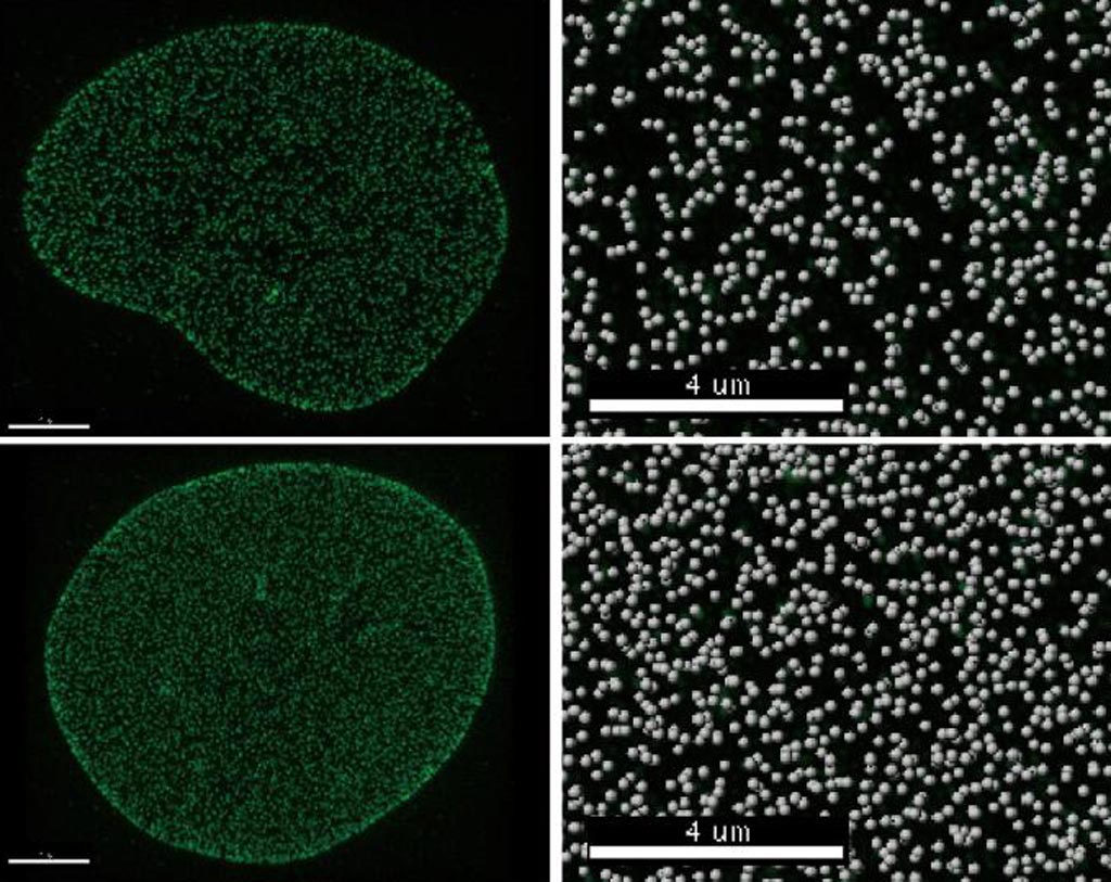 Image: Cells with the Tpr protein (top row) have fewer nuclear pores than cells without the protein (bottom row). The right column shows a close-up of the pore density, with many more pores appearing in the absence of Tpr (bottom left) (Photo courtesy of the Salk Institute for Biological Studies).