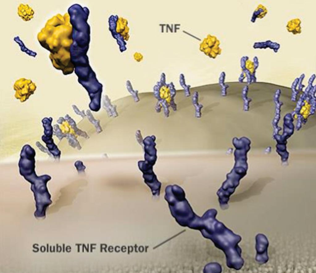 Image: Higher levels of the inflammatory biomarker soluble tumor necrosis factor receptor-1 (sTNFR-1) are tied to kidney decline in healthy adults (Photo courtesy of Enbrel).