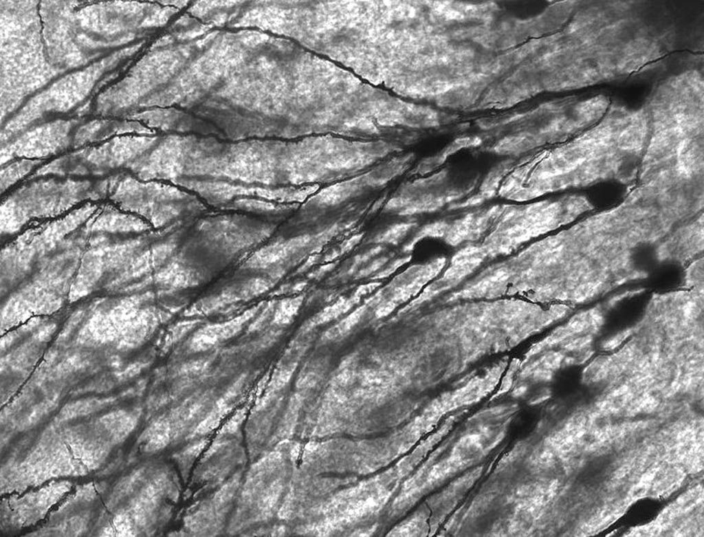Image: Golgi-stained neurons in human hippocampal tissue (Photo courtesy of Wikimedia Commons).