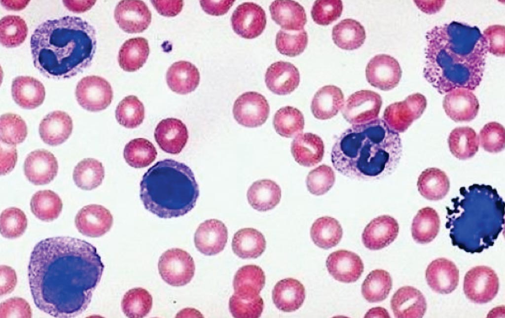 Image: A blood smear showing various leukocytes used to assess the complete white blood cell count by microscopy (Photo courtesy of the University of Minnesota).