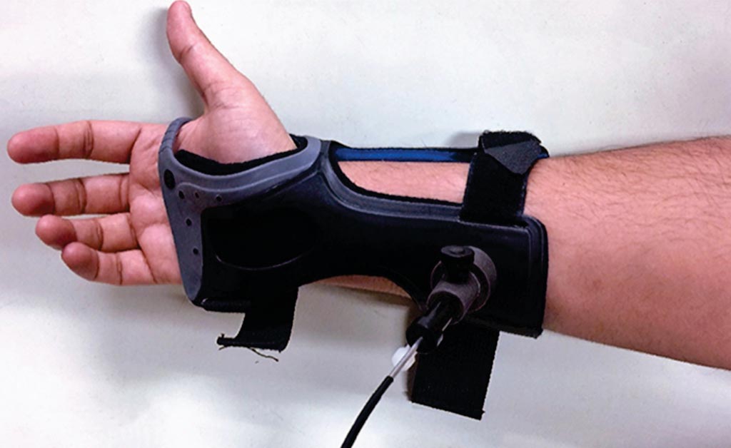 Это устройство использует лазерную технологию для определения уровня глюкозы под кожей, что является альтернативой болезненному покалыванию (фото любезно предоставлено Университетом Миссури-Колумбия).