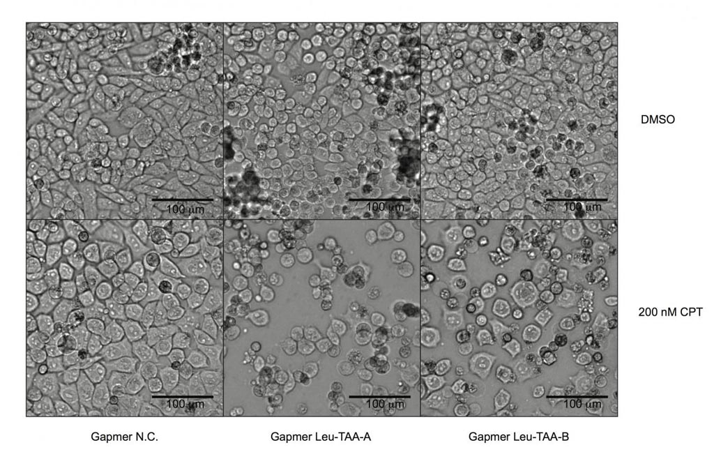 Image: Pancreatic cancer cells deficient in the expression of the human gene known as Schlafen 11 and resistant to chemotherapy (left panels) were re-sensitized to chemotherapeutic treatment (middle and right panels) by inhibiting the expression of the transfer RNA known as tRNA-Leu-TAA through specially designed antisense oligonucleotides (Photo courtesy of Manqing Li, Michael David Laboratory, University of California, San Diego).