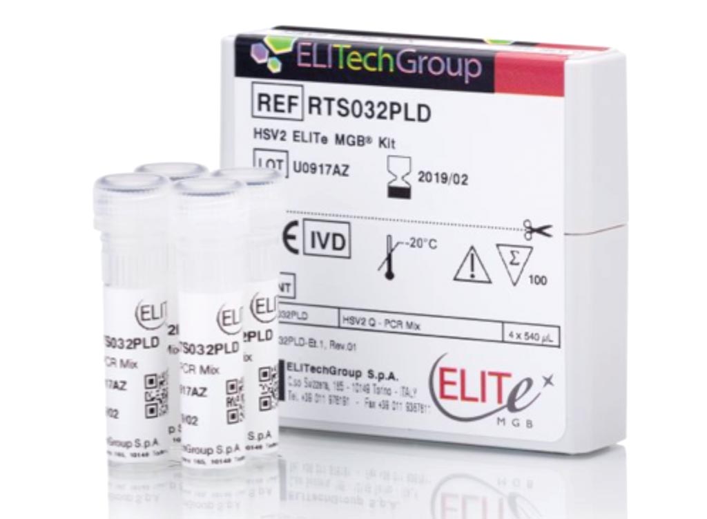 Image: The HSV2 ELITe MGB Kit is a real-time PCR assay designed for the detection and quantification of type 2 herpes simplex virus DNA (Photo courtesy of EliTech Group).