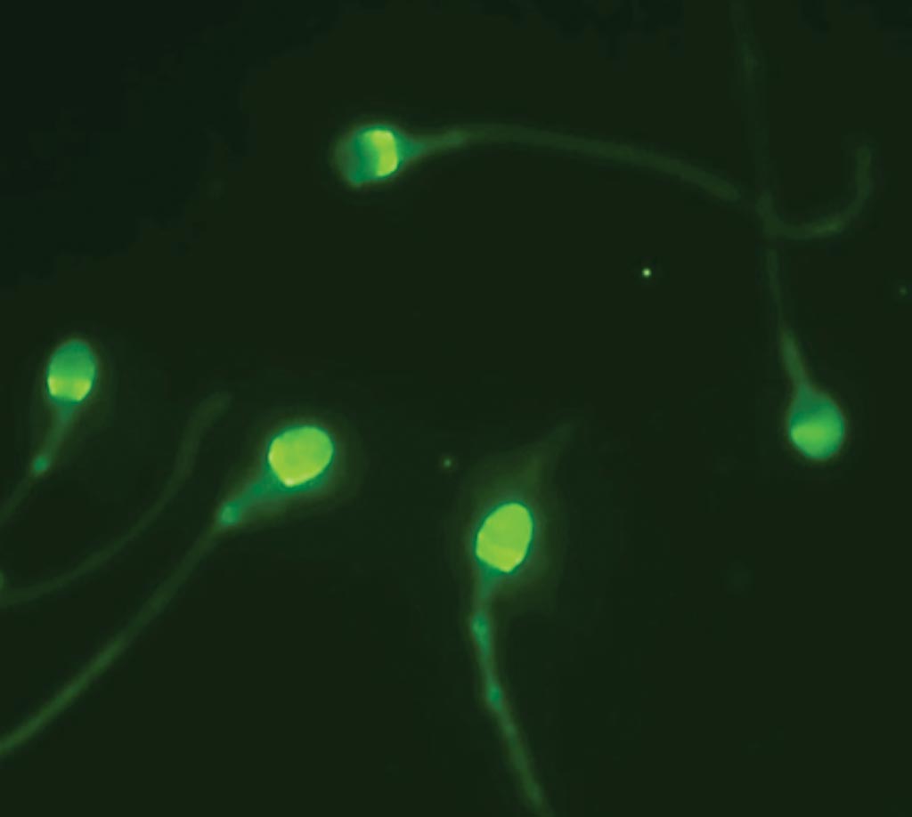 Cap-Score обнаруживает и анализирует картины локализации с использованием флуоресцентной микроскопии, чтобы отличить способных к зачатию сперматозоидов от не способных (фото любезно предоставлено Androvia LifeSciences).