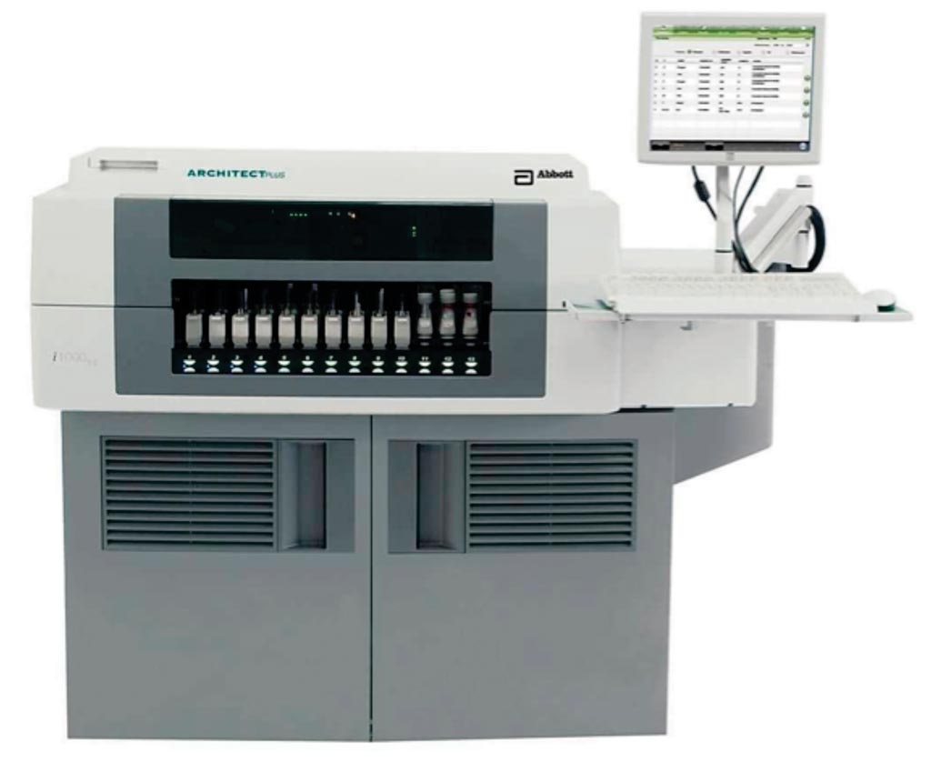 Image: The automatic immunoassay analyzer / chemiluminescence ARCHITECT i1000SR (Photo courtesy of Abbott Diagnostics).