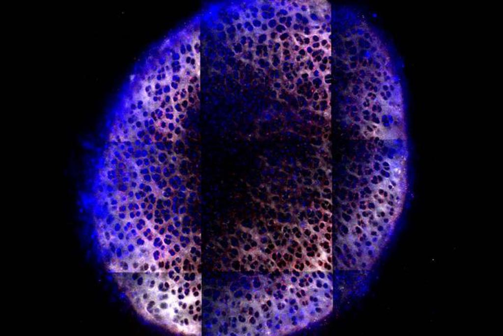 Image: Six days after treatment with IGF-1 carried by dendrimer nanoparticles (blue), the particles have penetrated through the cartilage of the knee joint (Photo courtesy of Brett Geiger and Jeff Wyckoff, Massachusetts Institute of Technology).