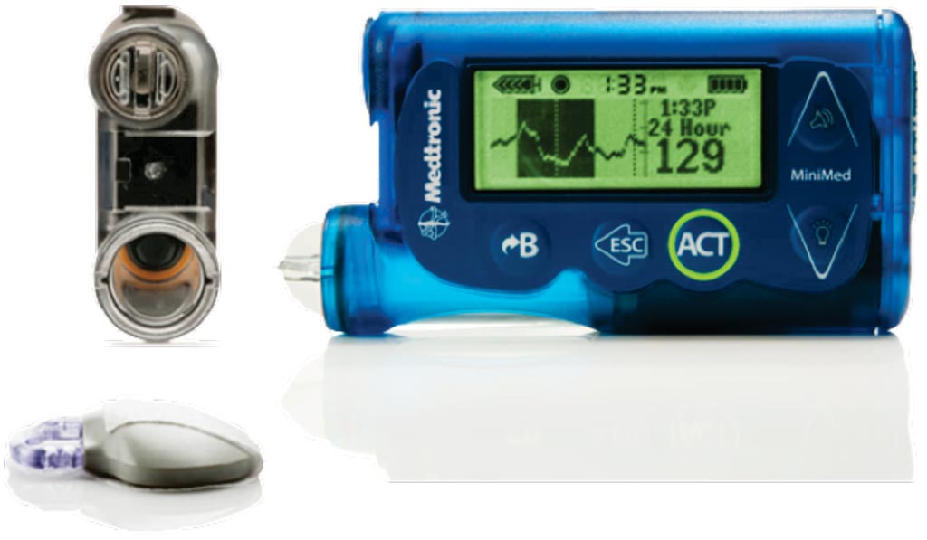 Image: The continuous glucose monitoring (CGM) system (Photo courtesy of Medtronic).