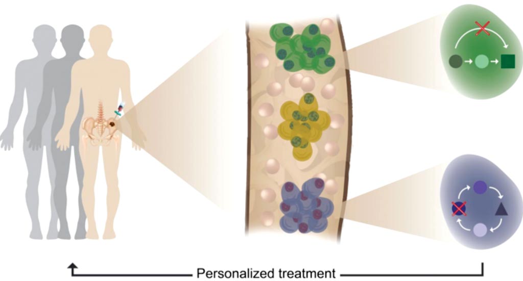 Image: Tumor heterogeneity, clonal evolution and therapy resistance was revealed using single cell profiling of multiple myeloma patients (Photo courtesy of Weizmann Institute of Science).