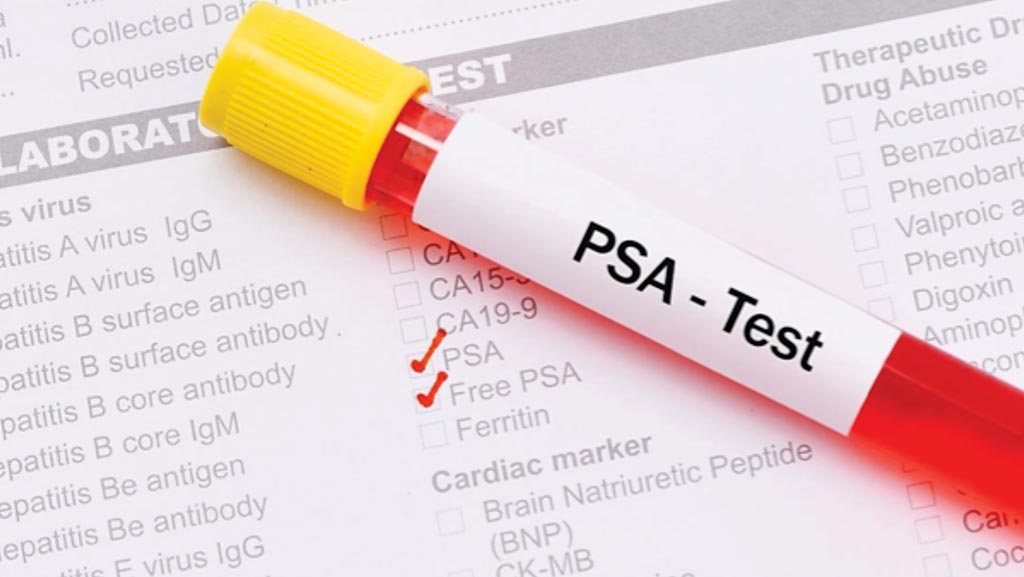 Image: Patients with inflammatory bowel disease who have an elevated PSA, may be at risk for prostate cancer (Photo courtesy of Harvard University).