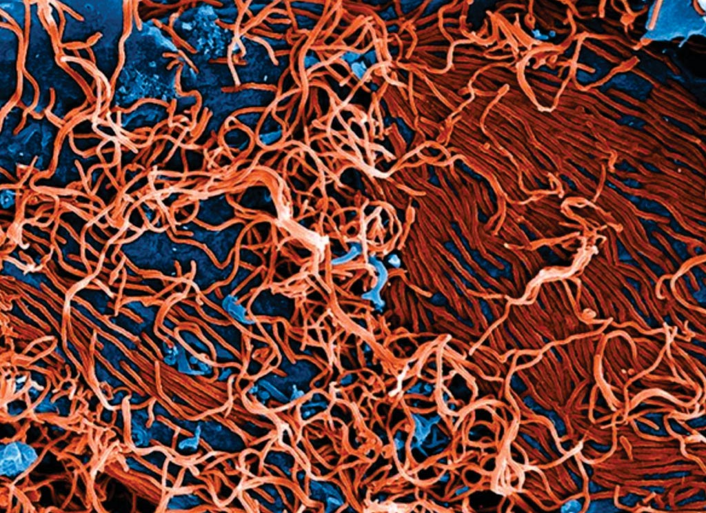 Image: Digitally colorized scanning electron microscopic (SEM) image depicts numerous filamentous Ebola virus particles (red) budding from a chronically infected VERO E6 cell (blue). New technology can distinguish Ebola infected patients from other endemic febrile diseases (Photo courtesy of National Institute of Allergy and Infectious Diseases).