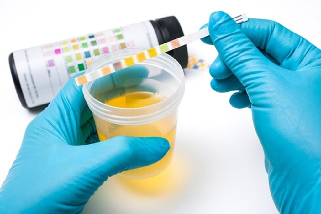 Image: The global urinalysis market is expected to reach a value of USD 1.5 billion by the end of 2024 (Photo courtesy of Shutterstock). Image: The global urinalysis market is expected to reach a value of USD 1.5 billion by the end of 2024 (Photo courtesy of Shutterstock).