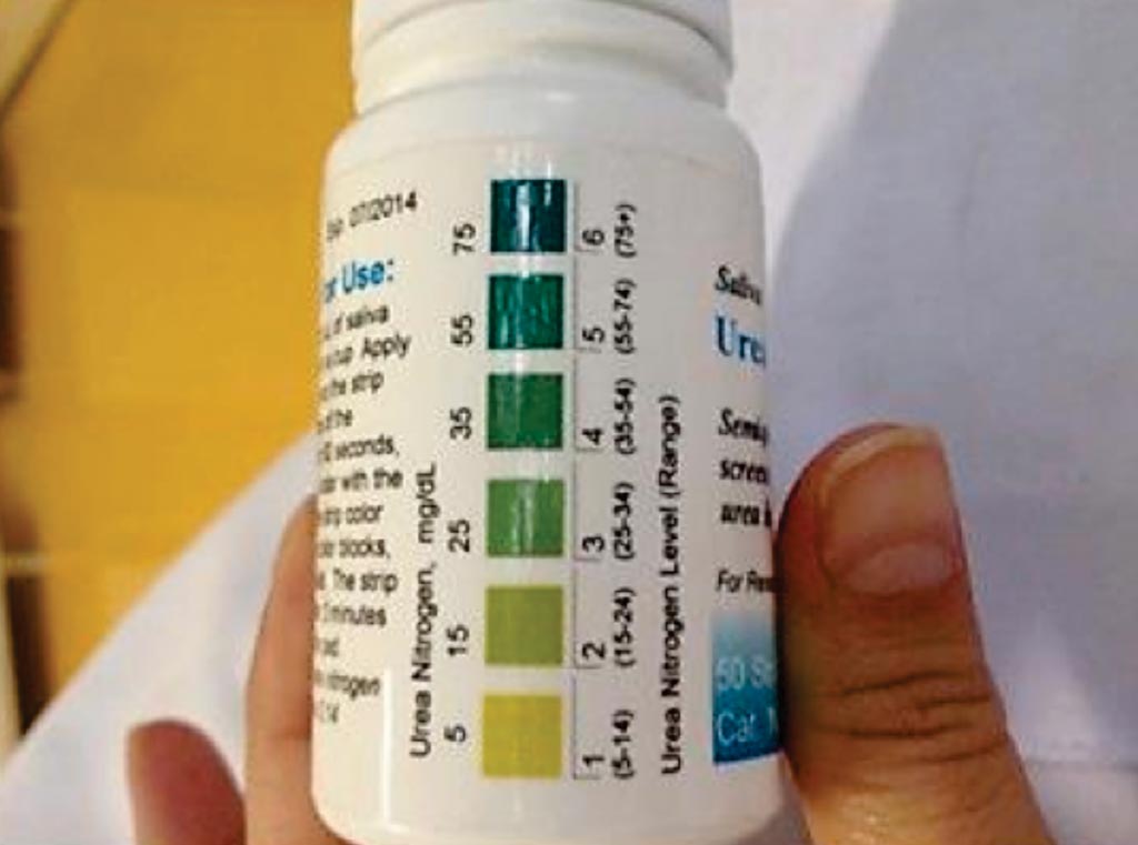 Image: A salivary urea nitrogen dipstick (Photo courtesy of University of Malawi College of Medicine).