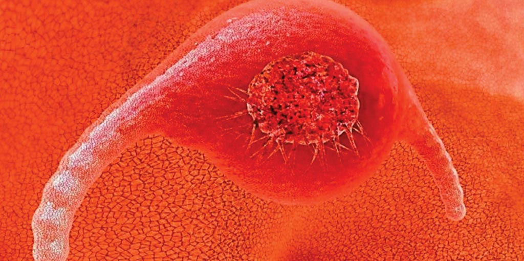 Image: A new screening method for cervical cancer has proven 100% accurate in testing (Photo courtesy of Health News).