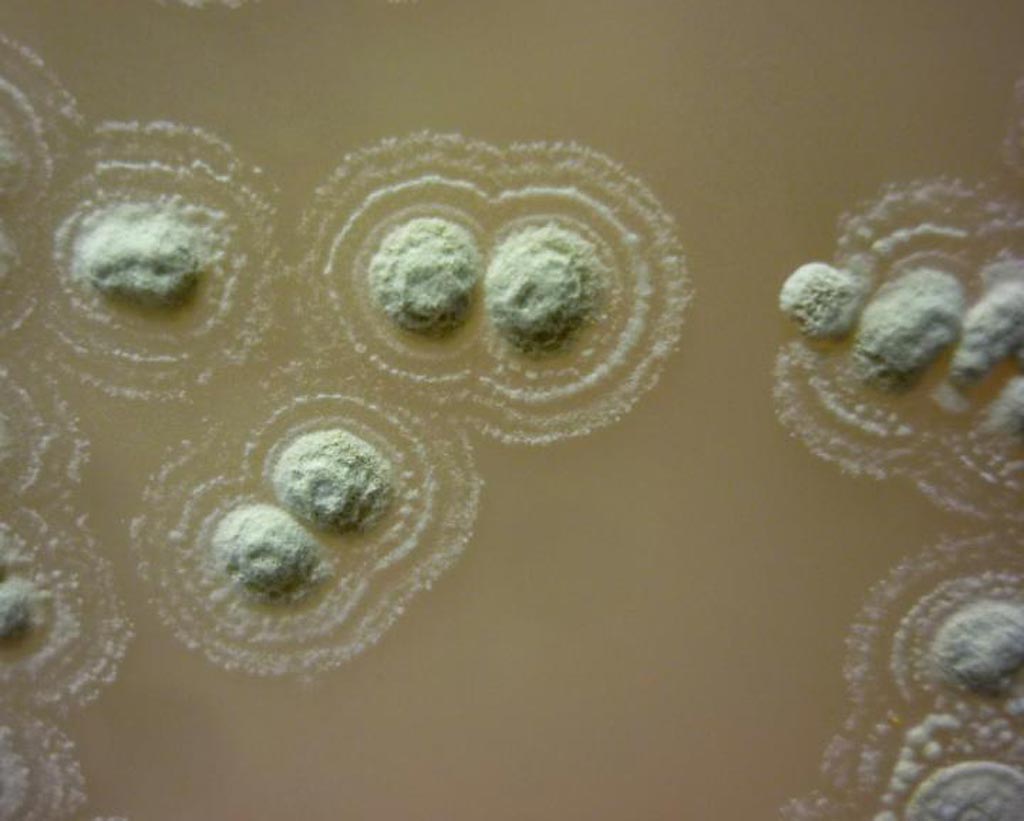 Image: Growth of the newly discovered Streptomyces sp. myrophorea, so named because it produces a distinctive fragrance similar to that of oil of wintergreen. Although superficially resembling fungi, Streptomyces are true bacteria and are the source of two-thirds of the various frontline antibiotics used in medicine (Photo courtesy of G. Quinn, Swansea University).