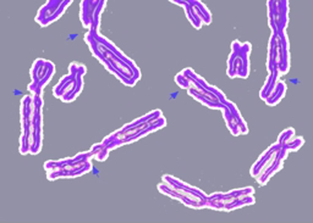 Image: An example of DNA damage causing multiple broken chromosomes (Photo courtesy of Wikimedia Commons).