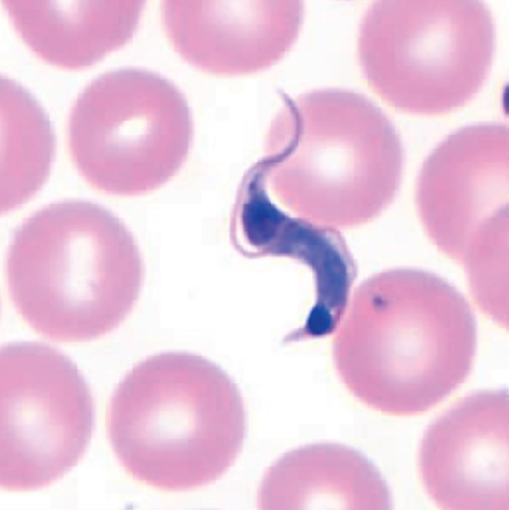 Image: Trypanosoma cruzi in thin blood smears stained with Giemsa (Photo courtesy of Centers of Diseases Control and Prevention).