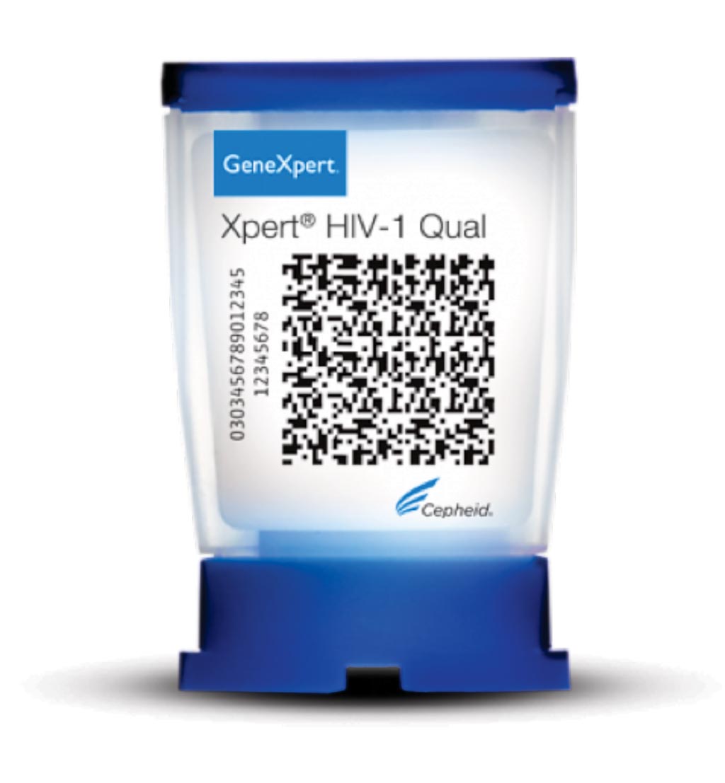 Image: The GeneXpert HIV-1 Qual is a highly sensitive HIV qualitative test is needed for detecting HIV infection in pediatric patients 18 months of age or younger (Photo courtesy of Cepheid).