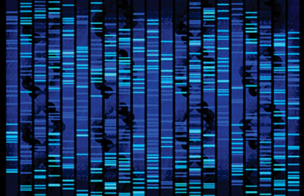 Image: Tumor Mutation Burden by Targeted Next Generation Sequencing Predicts Benefit to Immune Checkpoint Inhibitors for Cancer (Photo courtesy of Rutgers Cancer Institute).