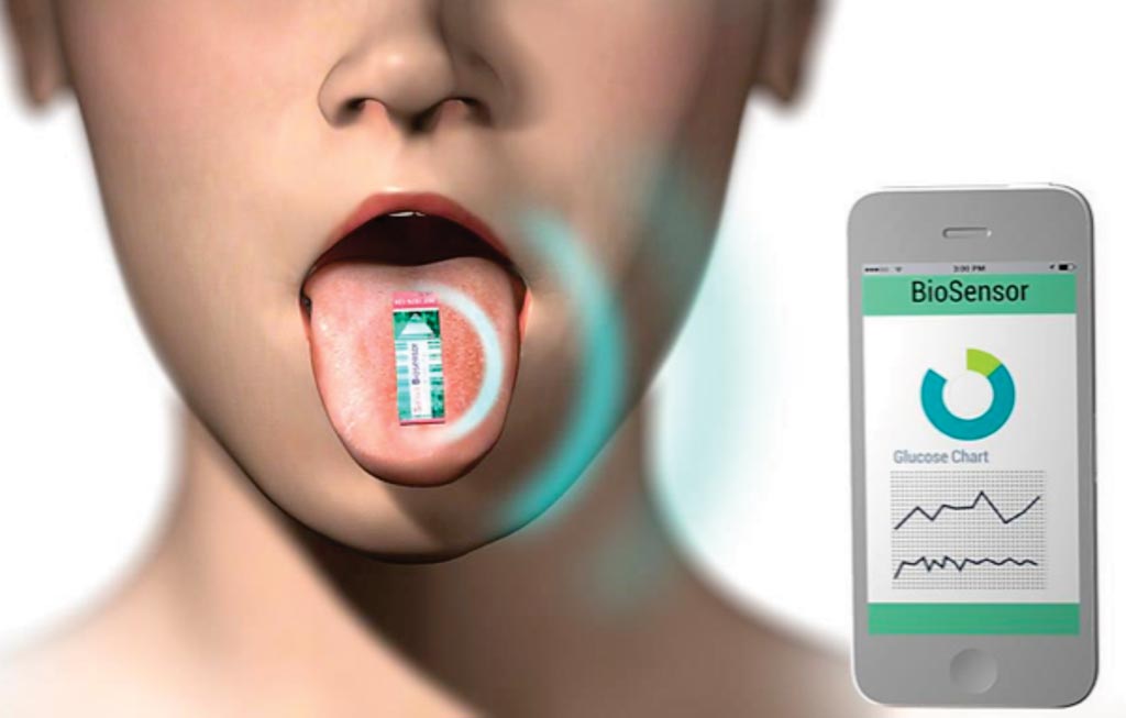 Image: The Saliva Glucose Biosensor that measures glucose in saliva rather than blood (Photo courtesy of iQ Group Global).