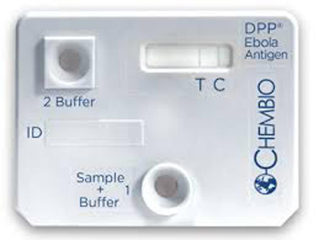 Тест на выявление вируса Эбола получил разрешение для использования в экстренных случаях (фото любезно предоставлено Chembio Diagnostic Systems).