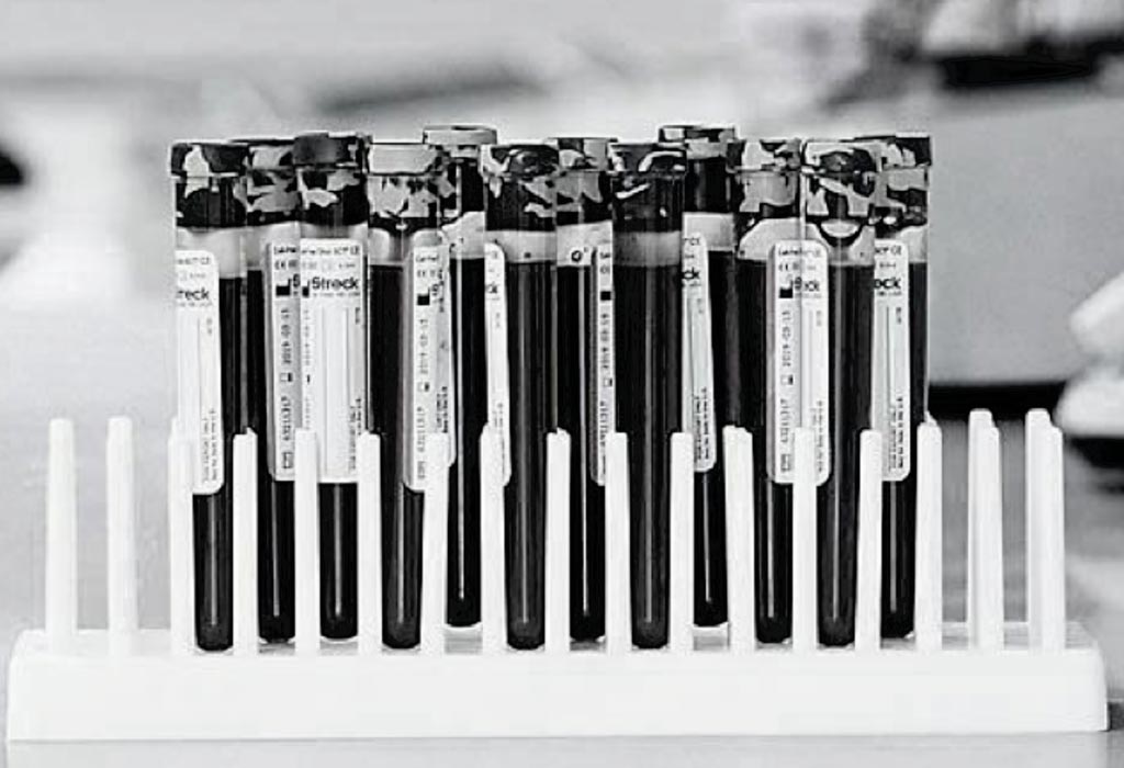 Image: Blood filled tubes used to preserve and stabilize cell-free DNA are also used in the PreSeek screening test (Photo courtesy of Streck).
