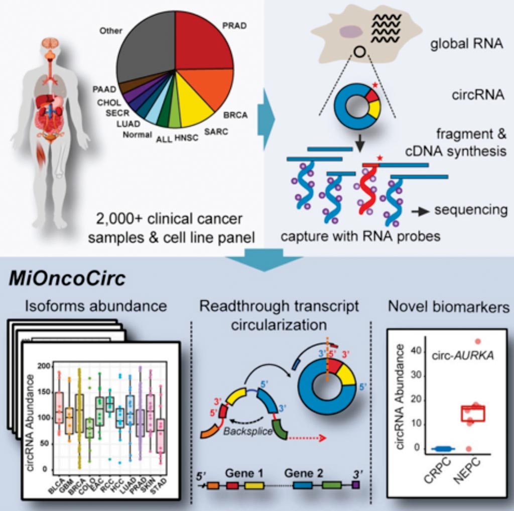 Image: A graphical interpretation of cancer-associated circular RNAs catalogued across tumor types (Photo courtesy of University of Michigan).