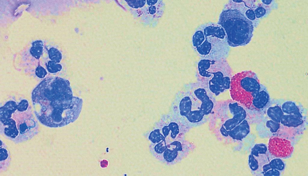 Image: A representative photomicrograph of bronchial lavage (BL) cytospin of obstructive airway disease participants Subsets of neutrophils characterized as per number of lobes in their nucleus (Photo courtesy of University of Newcastle).