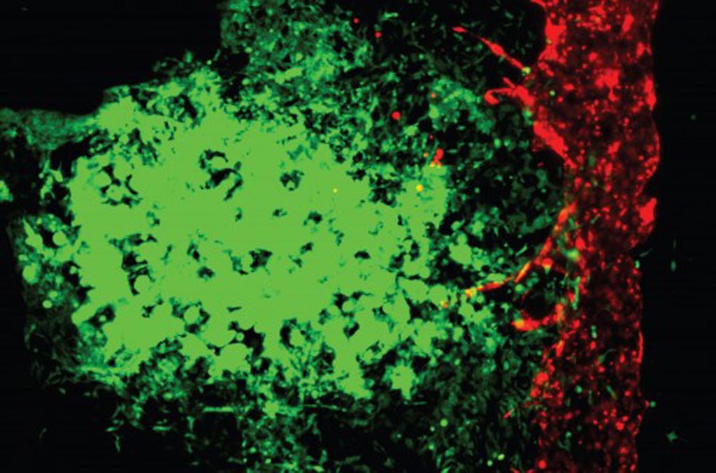 Image: Researchers found that cells behave differently in this three-dimensional (3D) soft tissue environment than on two-dimensional (2D) plastic or glass surfaces (Photo courtesy of the University of Minnesota).