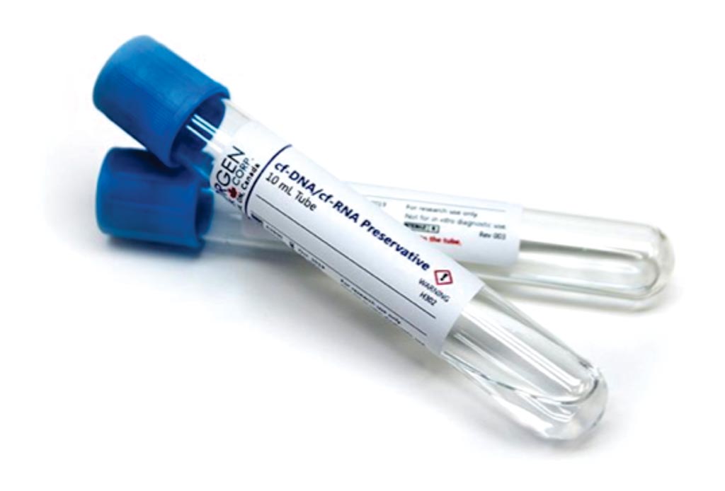 Image: The cf-DNA/cf-RNA Preservative tubes (Photo courtesy of Norgen Biotek).