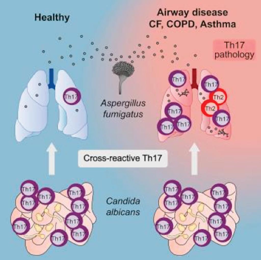 Image: A diagram of how human anti-fungal Th17 immunity and pathology rely on cross-reactivity against Candida albicans (Photo courtesy of the University of Kiel).