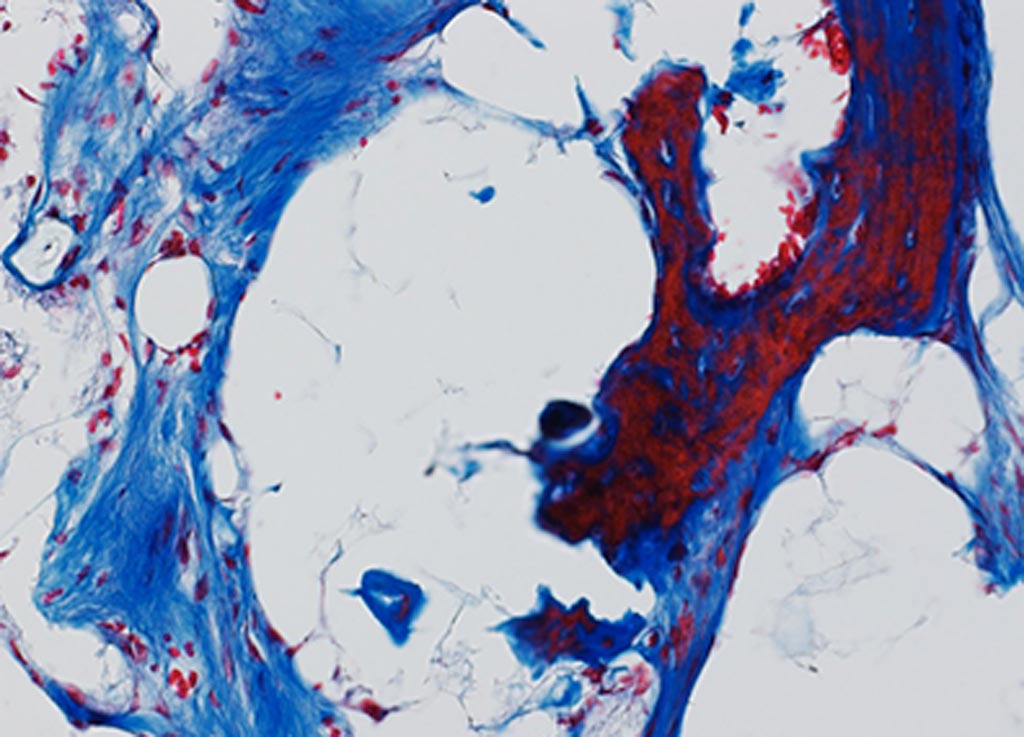 Image: Bone regenerates when two human cell populations (pericytes and adventitial cells) are mixed and implanted in a skull bone defect in immunocompromised mice (Photo courtesy of Yiyun Wang, Johns Hopkins University).