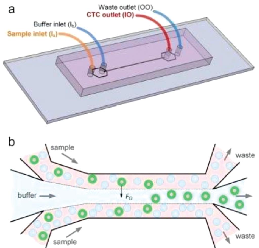 Image: A diagram shows how the microfluidics device separates cancer cells from blood. The green circles represent cancer cells (Photo courtesy of Professor Ian Papautsky, PhD).