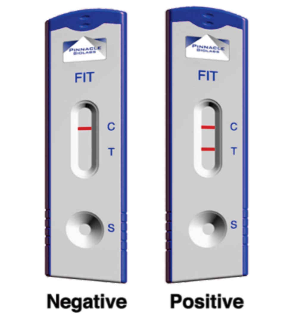 Image: The Fecal Immunochemical Test has been shown to detect colorectal cancer up to two years earlier than colonoscopy alone (Photo courtesy of Pinnacle BioLabs).