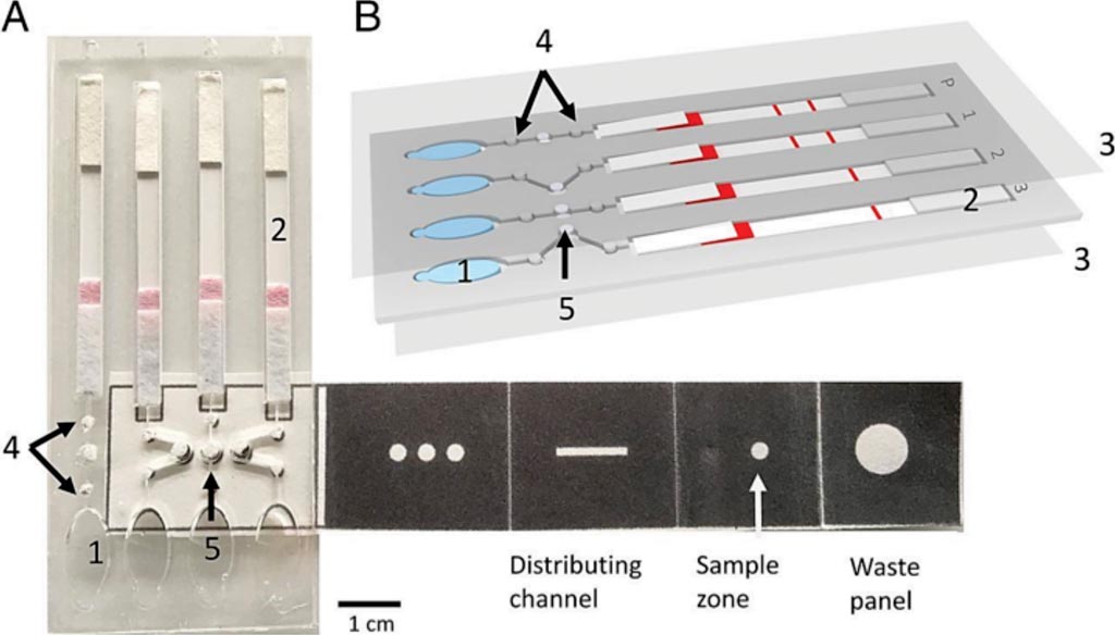Image: A paper-based microfluidic device enables multiplex LAMP-based detection of malaria in blood (Photo courtesy of University of Glasgow).
