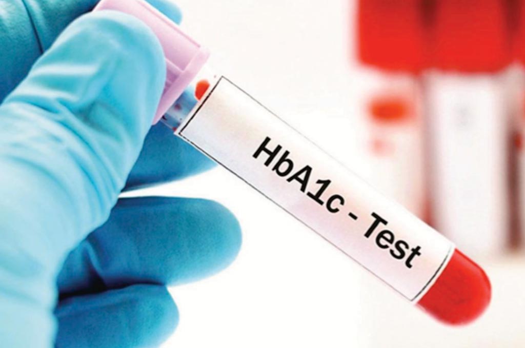 Image: The glycated hemoglobin or HbA1c test should not be solely used to determine the prevalence of diabetes (Photo courtesy of the Alberta Diabetes Foundation).