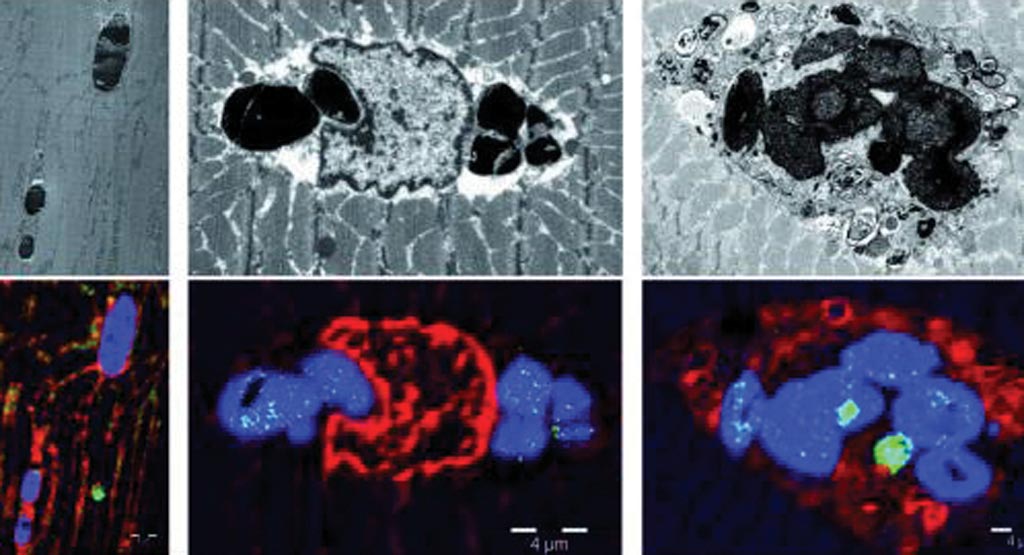 Image: Photomicrographs of tissues from patients with myoglobinopathy, a new muscular disease caused by a mutation in the myoglobin gene (Photo courtesy of Bellvitge Biomedical Research Institute).