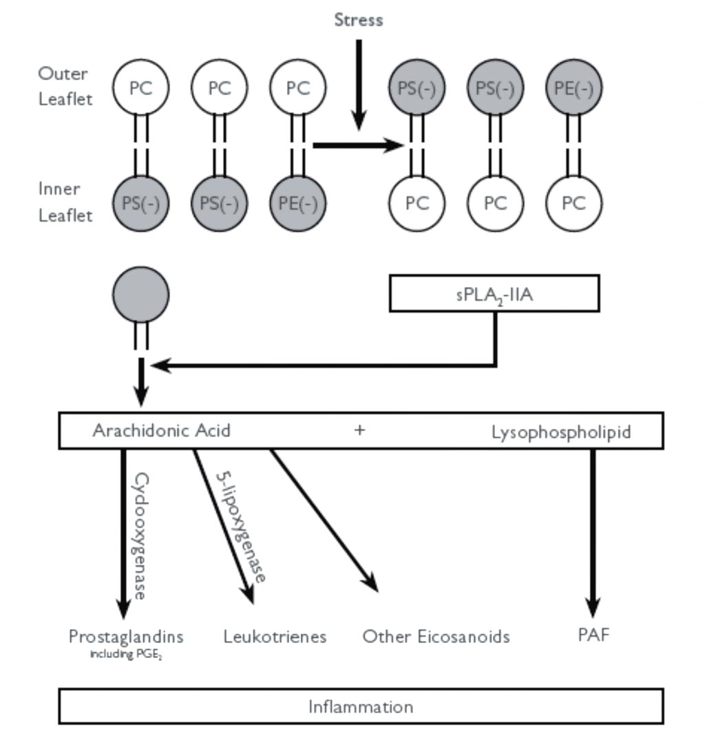 Image: The diagram shows how sPLA2-IIA binding to anionic phospholipids leads to its activation and promotes inflammation. The oxidation of the phospholipids produces stress, which causes the anionic phospholipids phosphatidylserine (PS) and phosphatidylethanolamine (PE) to be transported to the outer leaflet. This reaction activates cationic sPLA2-IIA. The higher activity of sPLA2-IIA promotes the hydrolysis of the outer leaflet phospholipids into arachidonic acid and lysophospholipids. Through the cyclooxygenase and 5-lipoxygenase enzymes, arachidonic acid is converted into prostaglandins, leukotrienes, and other inflammatory eicosanoids (Photo courtesy of Randox).