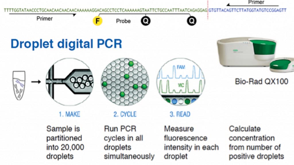 Image: Droplet digital PCR measures tumor load by non-invasive means. The technique takes advantage of the cell-free DNA circulating in blood, which is found in higher concentration in cancer patients (Photo courtesy of Christof Winter, MD, PhD).