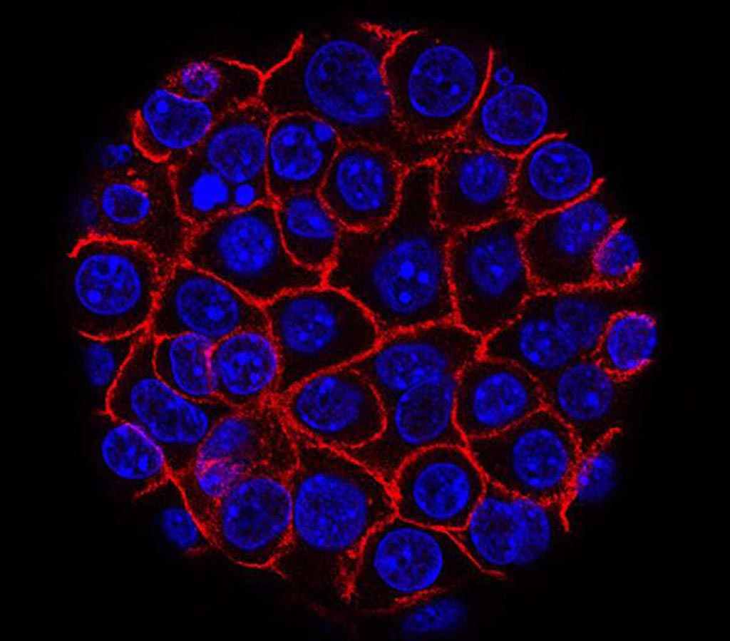 Image: Pancreatic cancer cells (blue) growing as a sphere encased in membranes (red) (Photo courtesy of the U.S. National Cancer Institute).