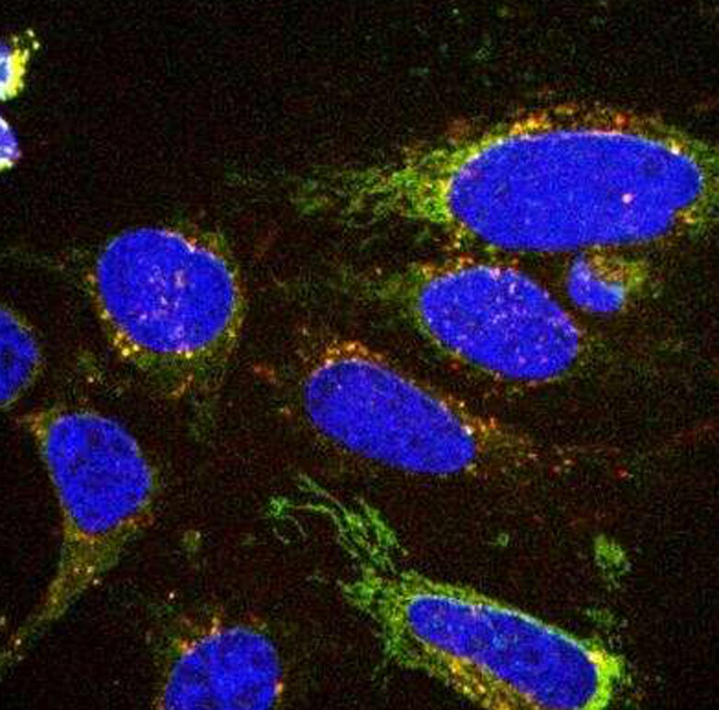 Image: New imaging technology based on fluorescent chemical probes enables visualization of what cells eat, which could aid the diagnosis and treatment of diseases such as cancer (Photo courtesy of the University of Edinburgh).